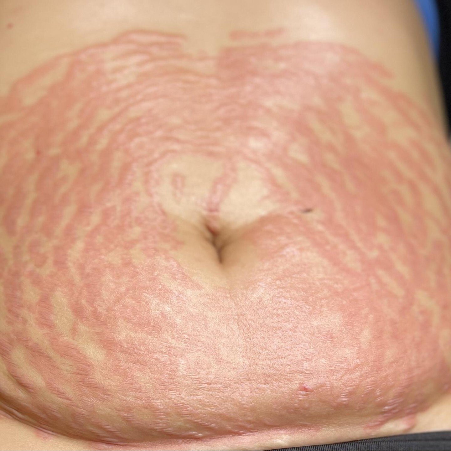 f6a8b6d7-d0c8-4442-8638-29e27b8607ed f6a8b6d7-d0c8-4442-8638-29e27b8607ed